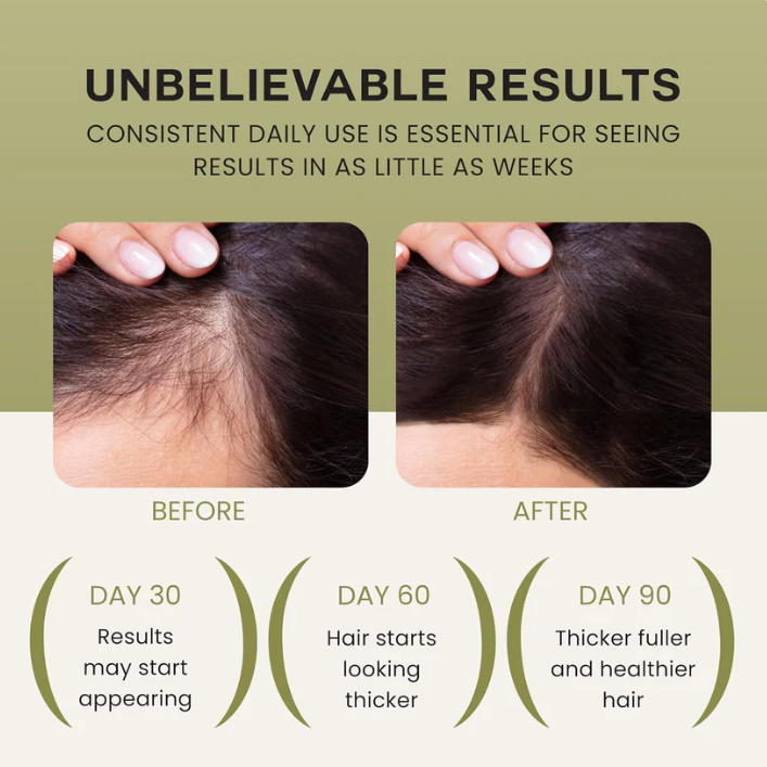 Wonder Growth Hair Oil Serum