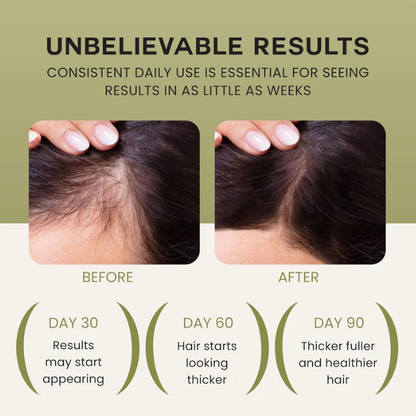 Wonder Growth Hair Oil Serum